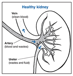 Drawing of a kidney cross section that shows a healthy kidney with the vein, artery, and ureter labeled and their functions described. 